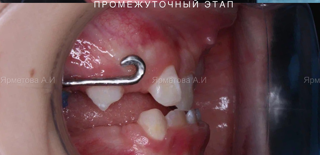 После